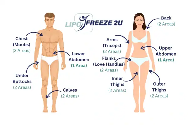 Areas you can have fat freezing treatment Spalding