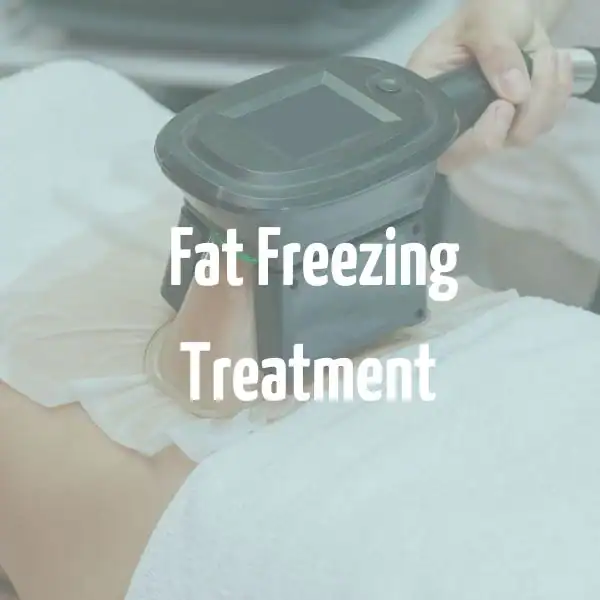 fat freezing treatment Spalding