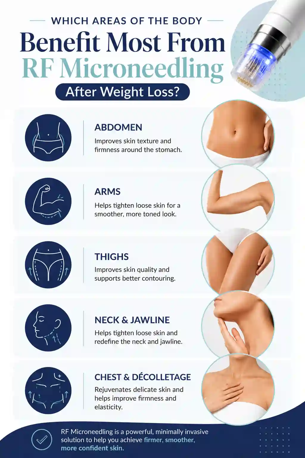 Which Areas of the Body Benefit Most From RF Microneedling After Weight Loss Spalding